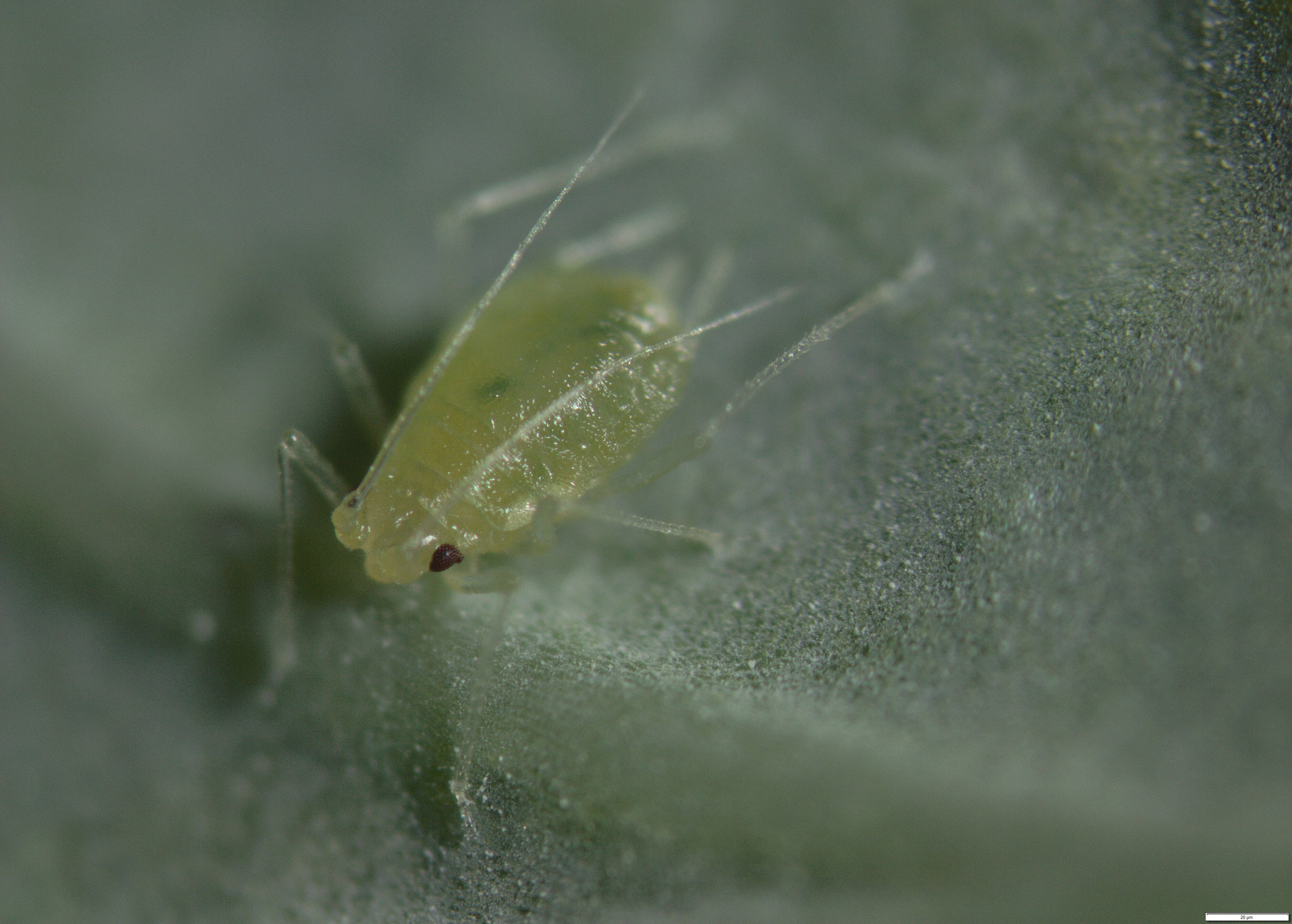 The close up photo taken under a stereo microscope of an aphid on a cabbage leaf 
- Overall Winner and Macro &amp; Textures Category Winner, Josefina Narciso