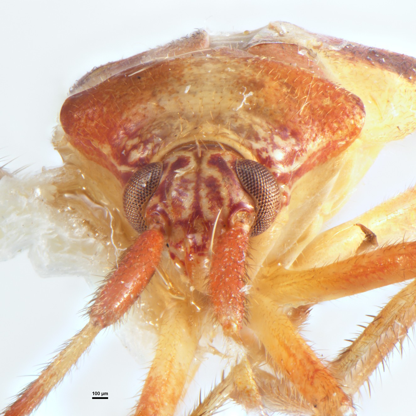 Hemiptera Anexochus crassicornis Holotype