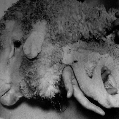 07 July 2025
Saving lives by rearranging sheep organs: How Lincoln helped revolutionise hormone research