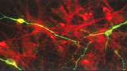 Sheep neurons in culture, part of Lincoln University's international acclaimed research into Batten Disease